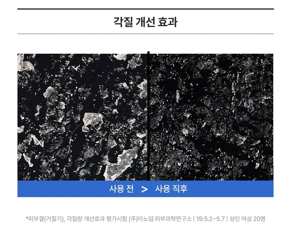 [미스트형/1등토너] 라운드랩 1025 독도 토너 300ml 1+1 기획 (+늘어나는 스킨패드 30매) 상세페이지 13